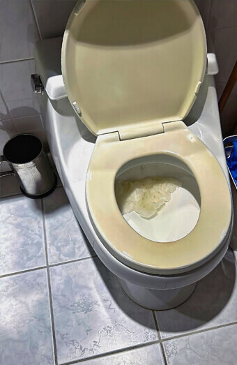 https://blockeddrainsbalcatta.com.au/uploads/2025/07/blocked-toilet-27293.jpg
